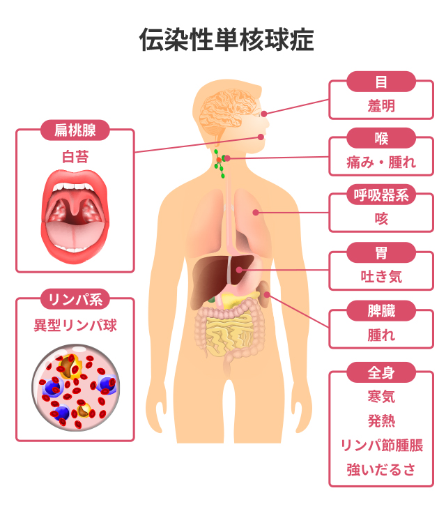 伝染性疾病 その他疾病