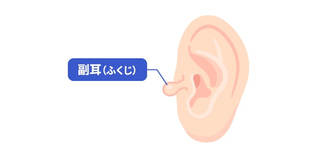 副耳を説明する図です