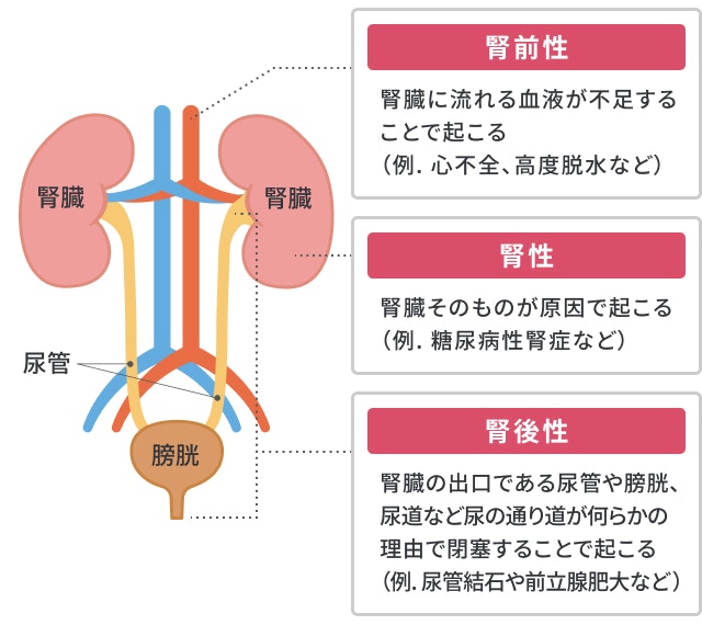 腎臓が悪くなる原因を説明する図です