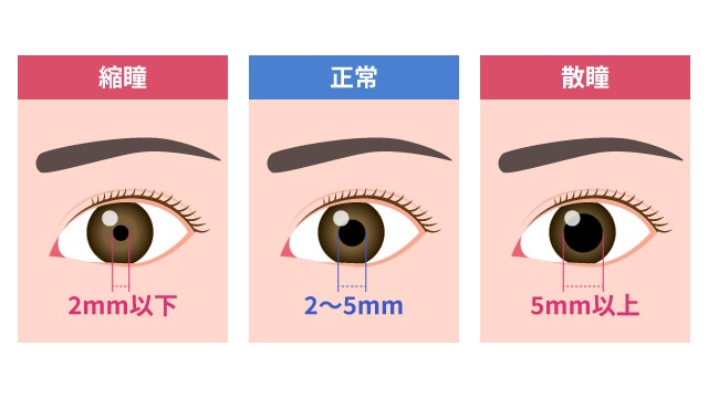 縮瞳について説明する図です