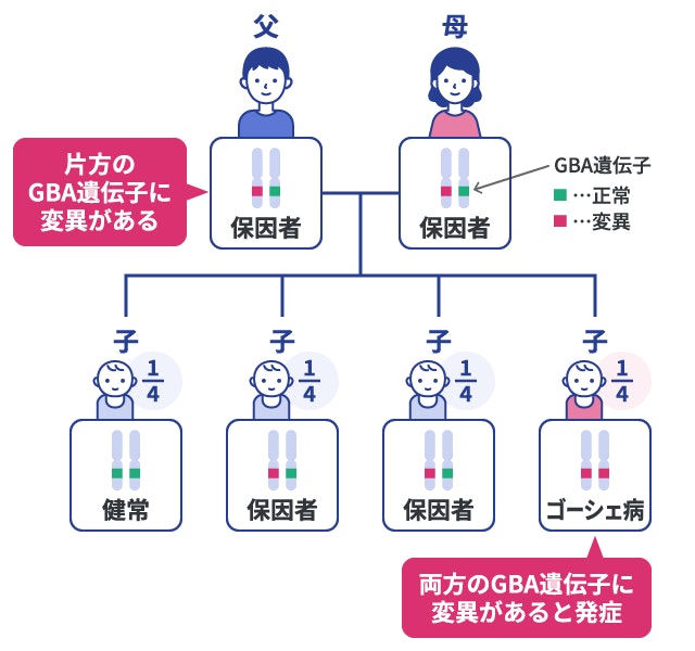 ゴーシェ病の遺伝形式と確率を示す家系図イラスト。両親がどちらもGBA遺伝子の片方に変異を持つ「保因者」である場合、子供の4分の1（25%）が健常、4分の2（50%）が保因者となり、残る4分の1（25%）が両方の遺伝子に変異を受け継いで「ゴーシェ病」を発症する仕組みを図解。
