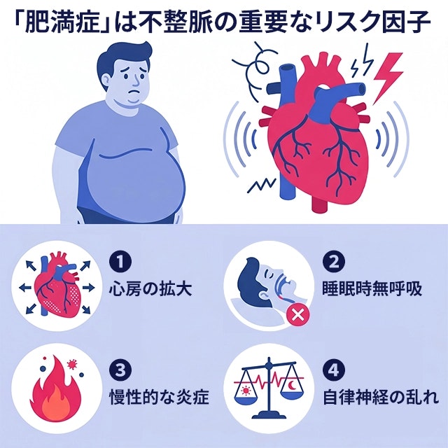肥満症が不整脈(心房細動など)の大きな原因となる理由を、心房の拡大、睡眠時無呼吸、慢性的な炎症、自律神経の乱れという4つの要因に分け、心臓などのアイコンを用いて解説したイラストです。