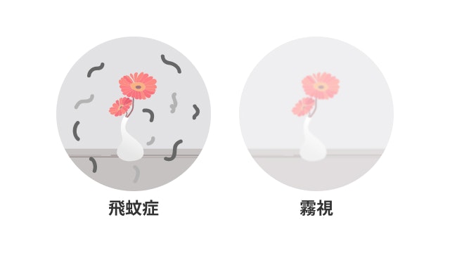 硝子体出血の場合の見え方を説明する図です