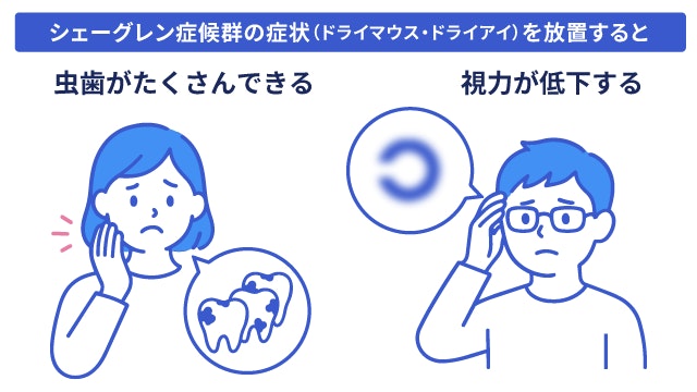シェーグレン症候群の症状を放置した場合のリスクを示した啓発イラスト。ドライマウスによる多発する虫歯や、ドライアイ悪化による視力低下など、未治療が引き起こす健康被害を警告する図。