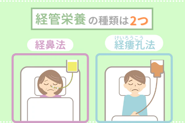経管栄養の種類は2つ 経鼻法 経瘻孔法