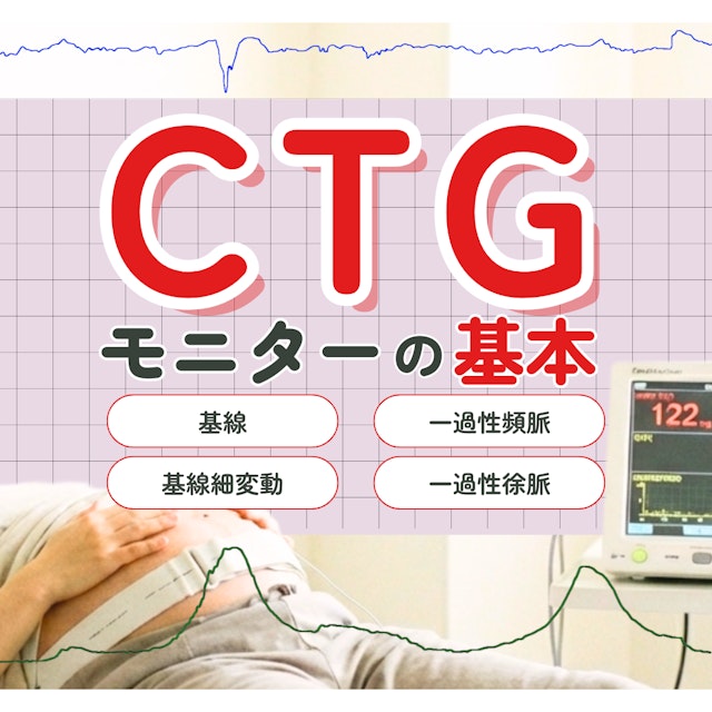 【新人助産師と学生が押さえておきたい】CTG（NST）モニターの基礎知識｜基線・基線細変動・一過性頻脈の見方をわかりやすく解説
