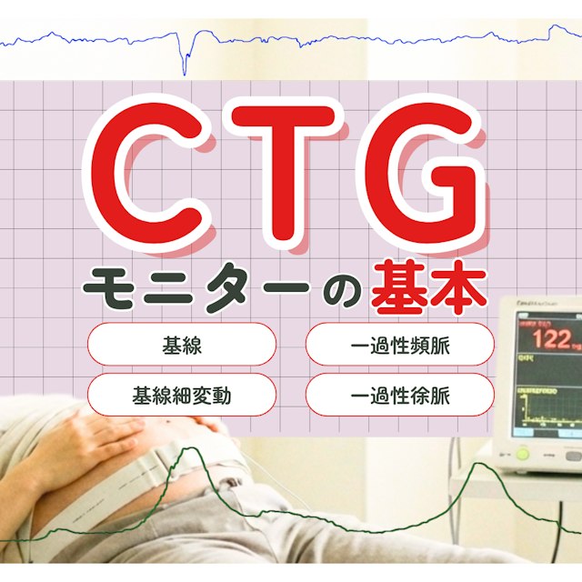 新人助産師と学生が押さえておきたい】CTG（NST）モニターの基礎知識