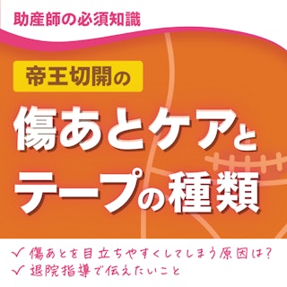 【助産師の必須知識】帝王切開の傷あとケアとテープの種類｜傷あとを目立ちやすくしてしまう原因は？｜退院指導で伝えたいこと