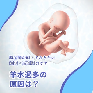 羊水過多の原因は?助産師が知っておきたい妊娠・分娩期のケア