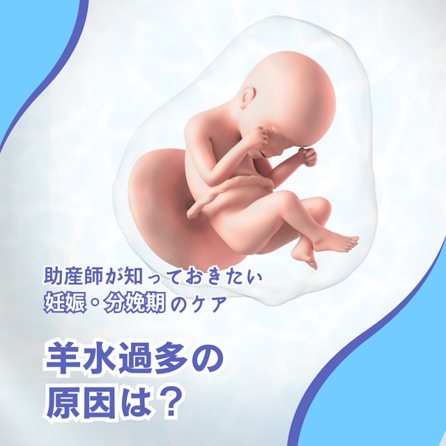 羊水過多の原因は?助産師が知っておきたい妊娠・分娩期のケア