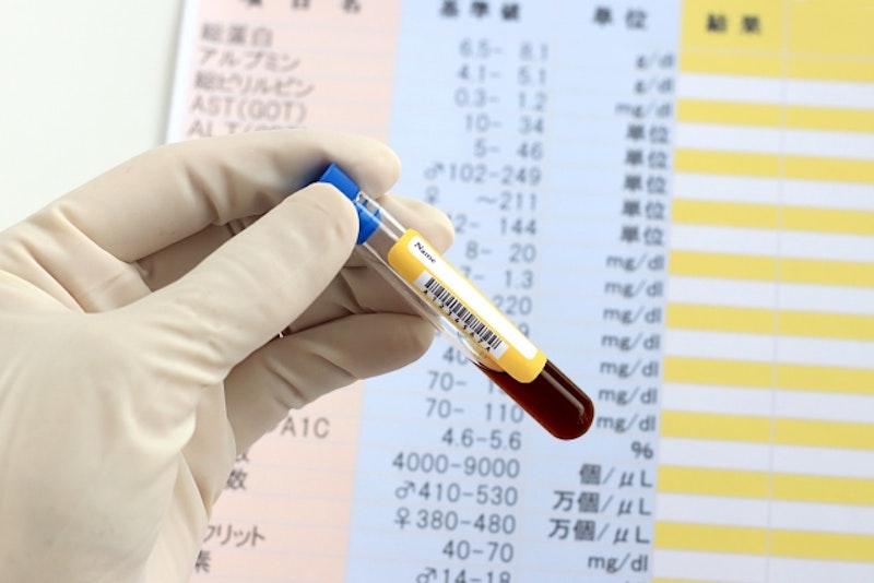助産師のための出生前診断ガイド|検査の種類・適応週数・診断可能な疾患をわかりやすく解説