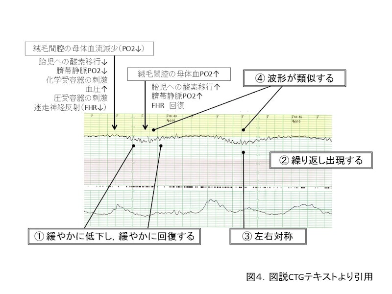 【新人助産師と学生が押さえておきたい】CTG（NST）モニターの基礎知識｜基線・基線細変動・一過性頻脈の見方をわかりやすく解説