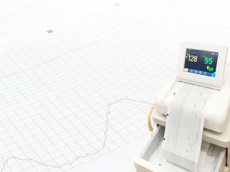 無痛分娩の管理と看護|助産師が知っておきたい観察項目・対応まとめ