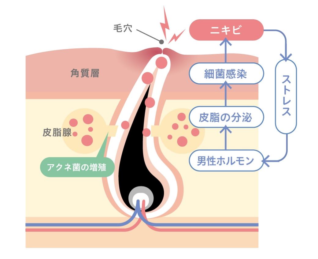 タオル 人気 菌 ニキビ