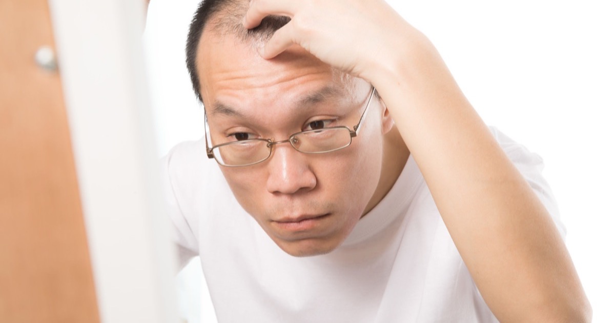 脂漏性皮膚炎とは AGAとの関係や治療法について