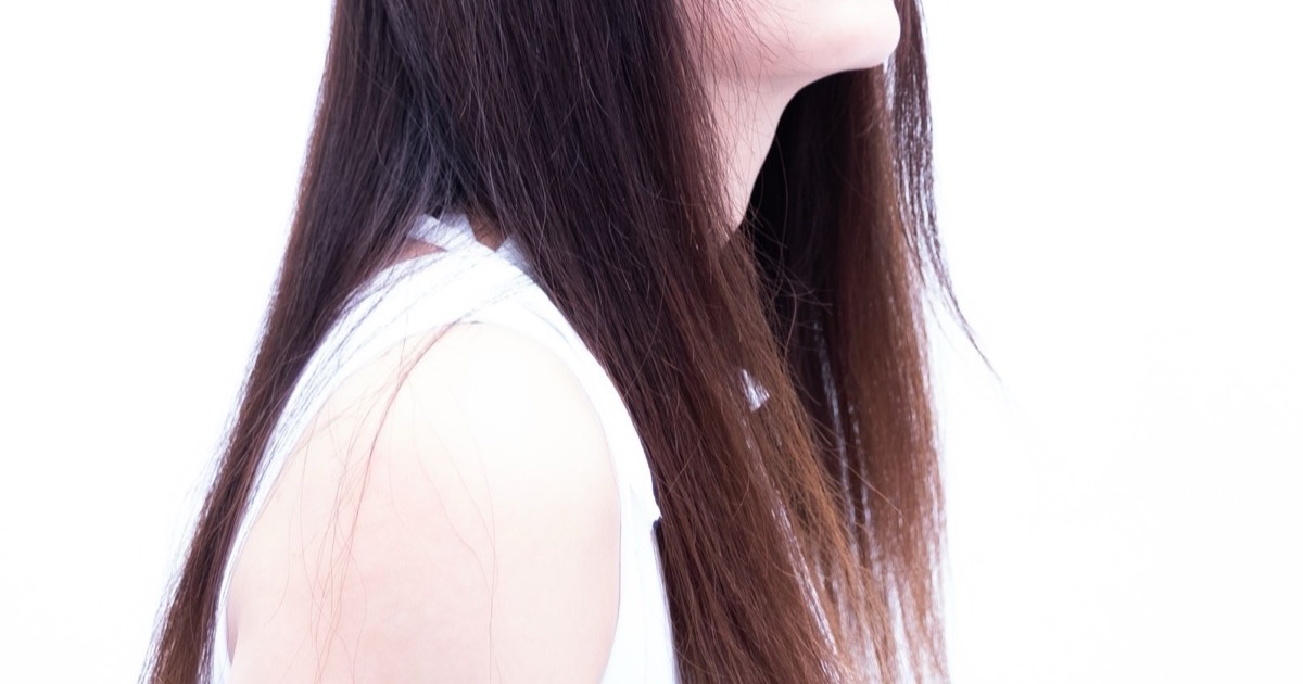女性の薄毛や抜け毛の原因とは 脱毛症の種類や治療法について