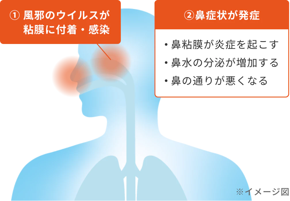 ①風邪のウイルスが粘膜に付着・感染②鼻症状が発症:鼻粘膜が炎症を起こす、鼻水の分泌が増加する、鼻の通りが悪くなる
