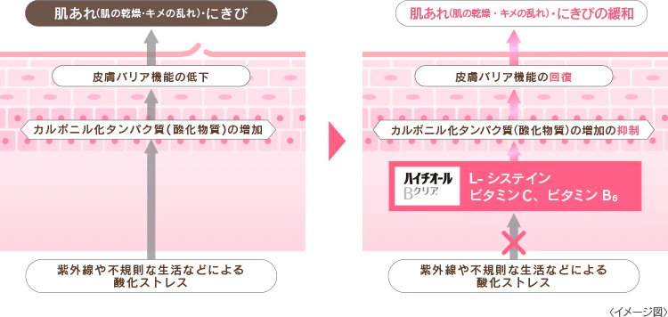 皮膚バリア機能の低下と改善