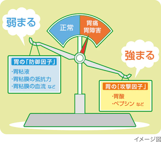 胃の「防御因子」と胃の「攻撃因子」