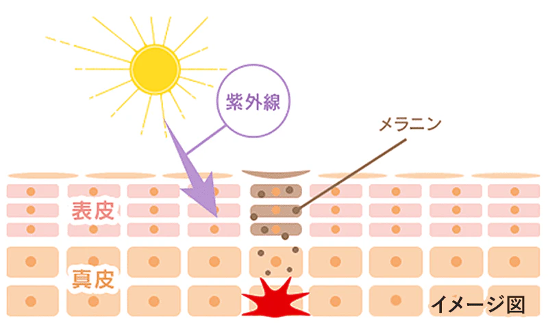 シミ