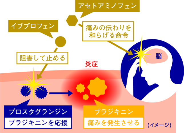 プロスタグランジンの生成を抑制する鎮痛成分を配合