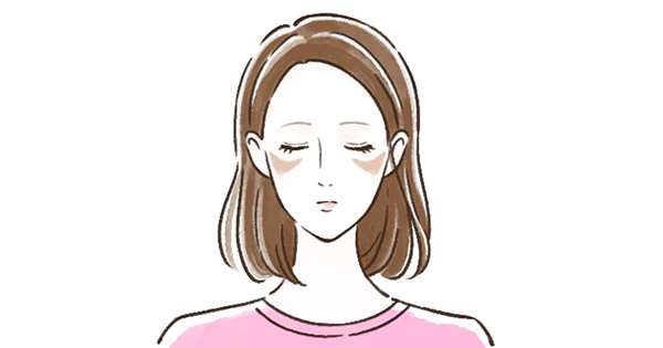 肝斑（かんぱん）のイメージ