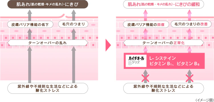 ターンオーバーの乱れと正常化