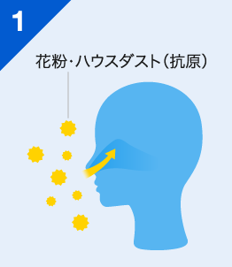 1 花粉・ハウスダスト(抗原)