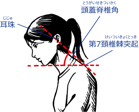 耳珠、頭蓋脊椎角、第7頚椎棘突起