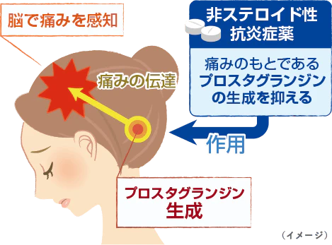 市販の頭痛薬の成分と鎮痛効果の図説