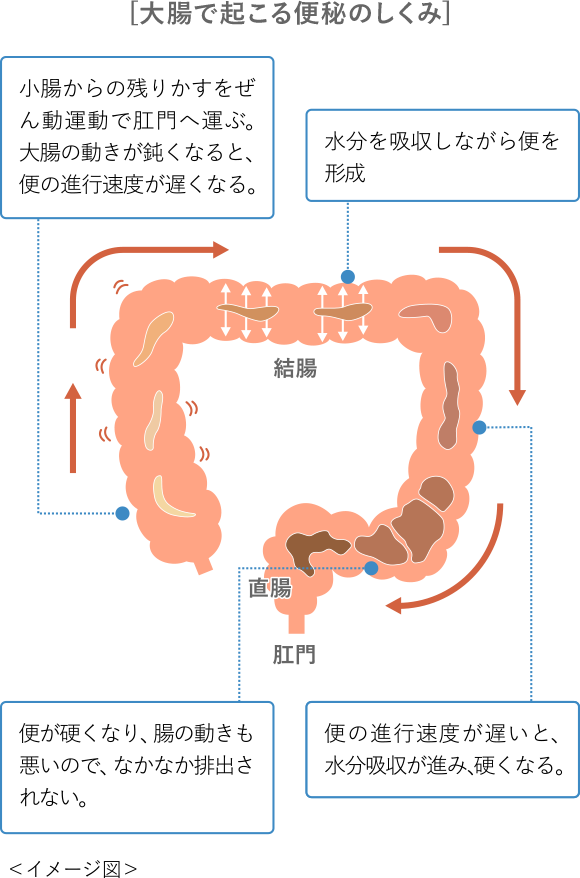 [大腸で起こる便秘のしくみ] イメージ図