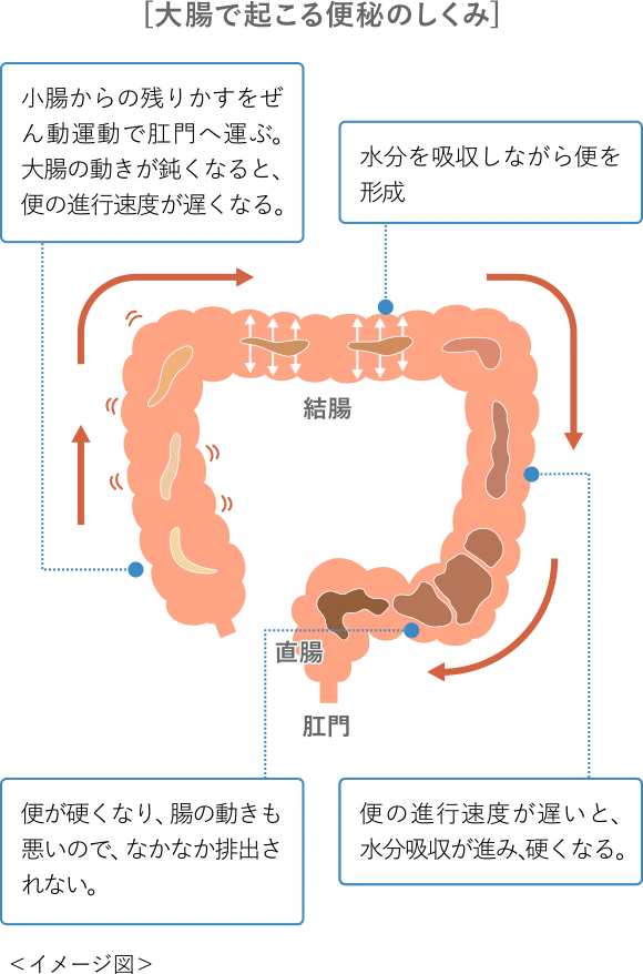 [大腸で起こる便秘のしくみ] イメージ図