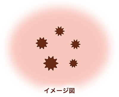 プロスタグランジンの生成量が多い