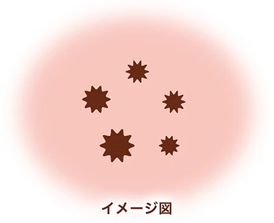 プロスタグランジンの生成量が多い