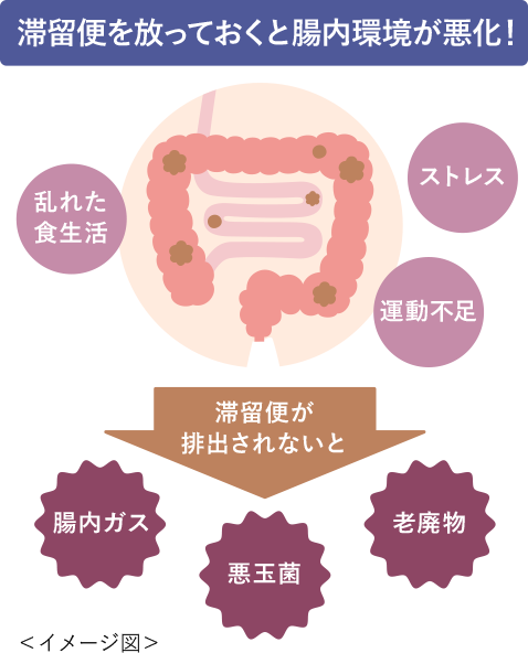 滞留便を放っておくと腸内環境が悪化！イメージ図