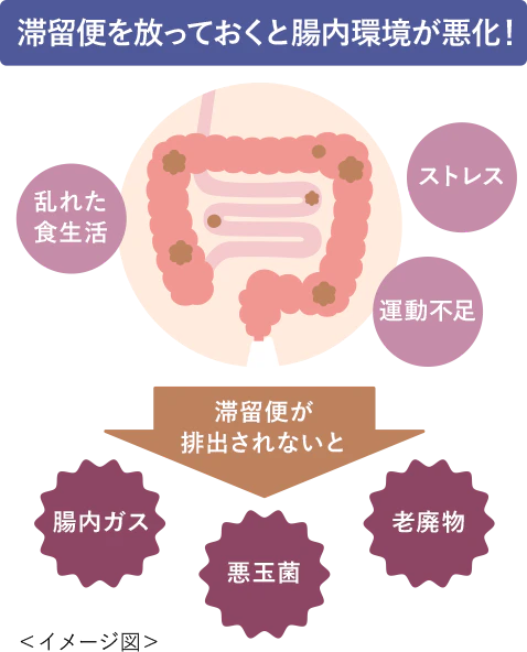 滞留便を放っておくと腸内環境が悪化！イメージ図
