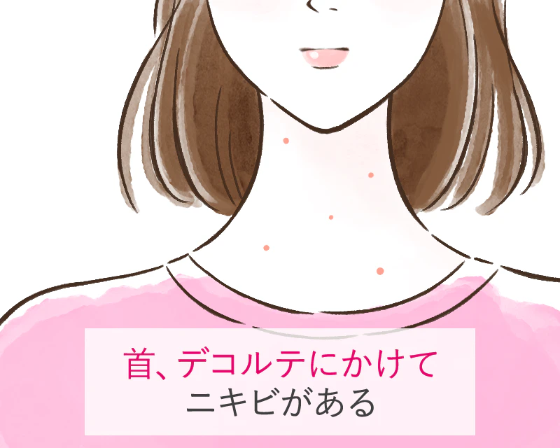 首やデコルテにできるニキビ