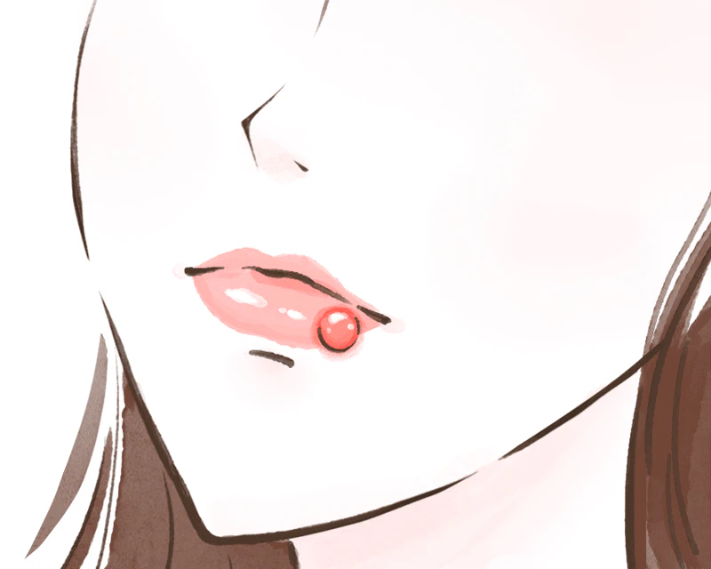 ヘルペス性口内炎のイメージ