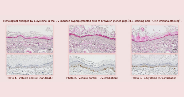 Histological changes by L-cysteine in the UV induced hyperpigmented skin of brownish guinea pigs (H-E staining and PCNA immuno-staining) .Photo 1. Vehicle control (non-treat.)Photo 2. Vehicle control (UV-irradiation)Photo 3. L-Cysteine (UV-irradiation)