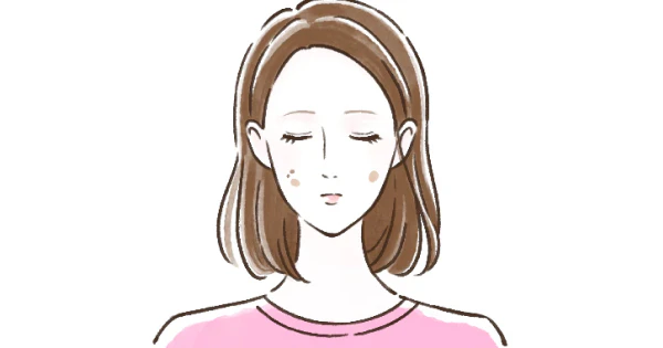 炎症後色素沈着