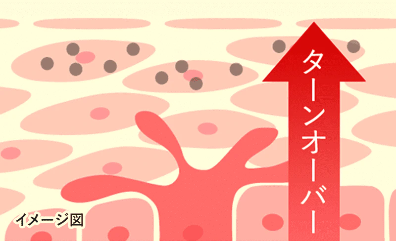 ターンオーバーの促進で色素沈着をケア
