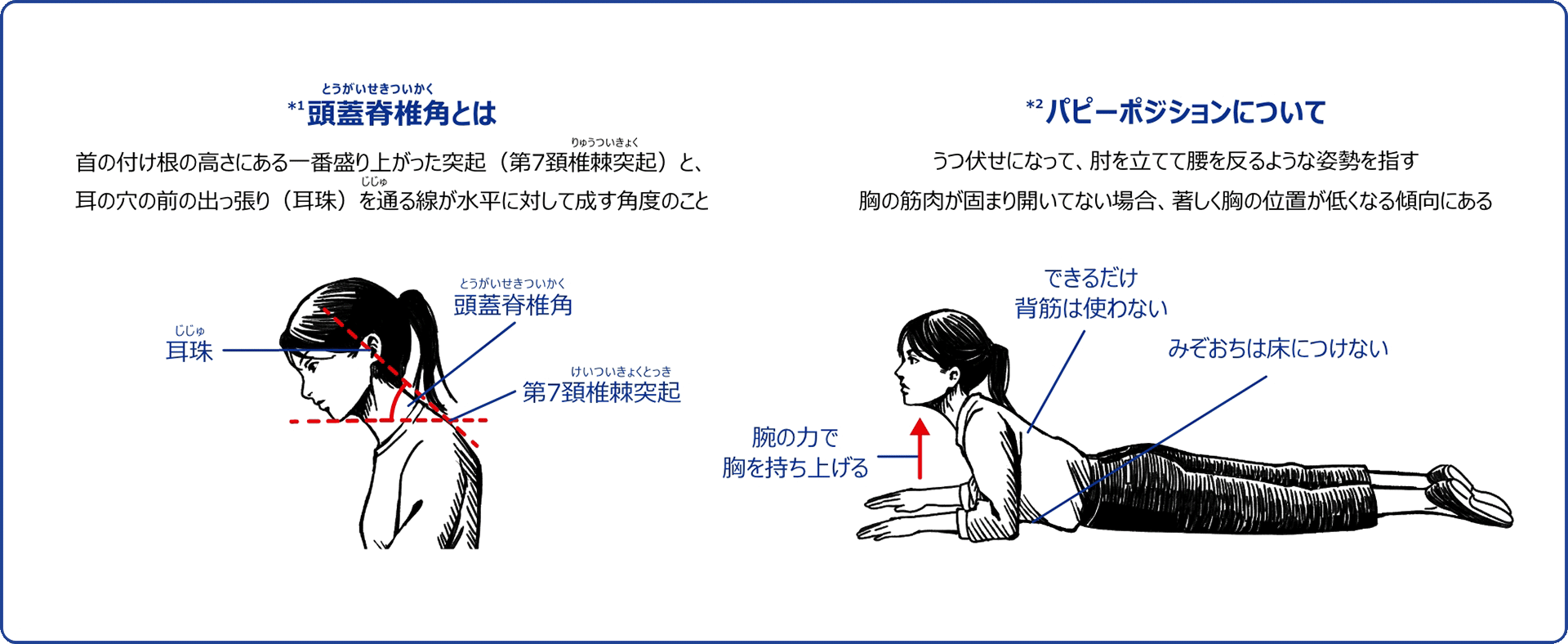 頭蓋脊椎角とは　パピーポジションとは　イメージ