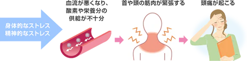 緊張型頭痛が起こるメカニズム