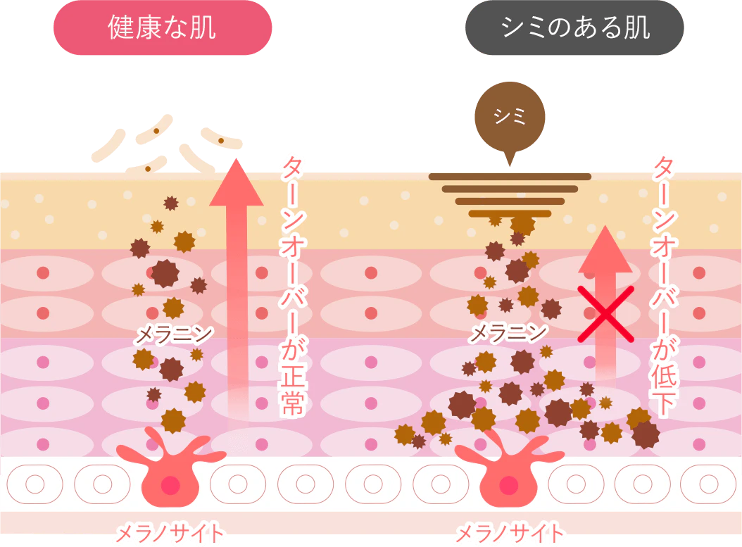 健康な肌とシミのある肌