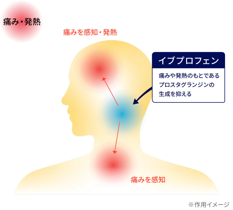痛み・発熱の作用イメージ図 イブプロフェン：痛みや発熱のもとであるプロスタグランジンの生成を抑える