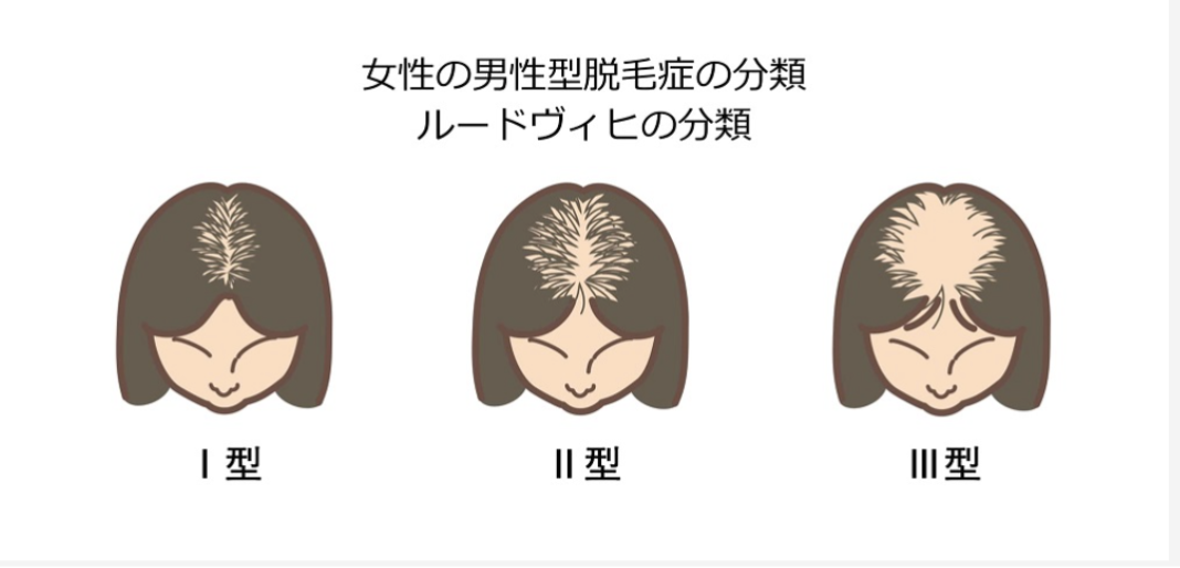 1.タイトル入ります