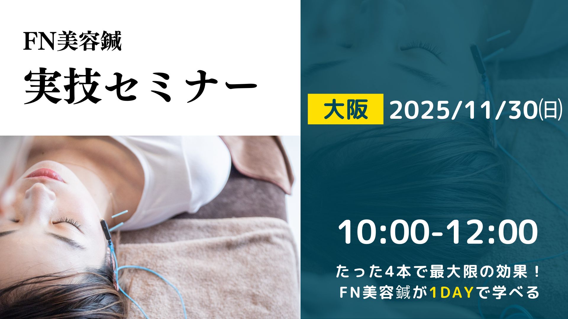 FN美容鍼　実技セミナー