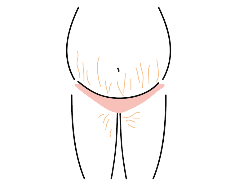 妊娠線予防のお腹