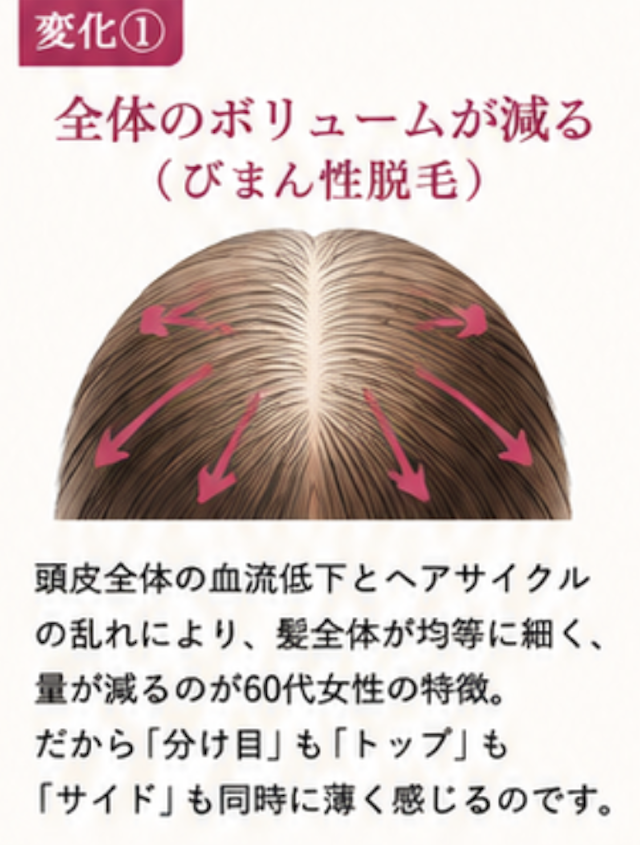 変化1