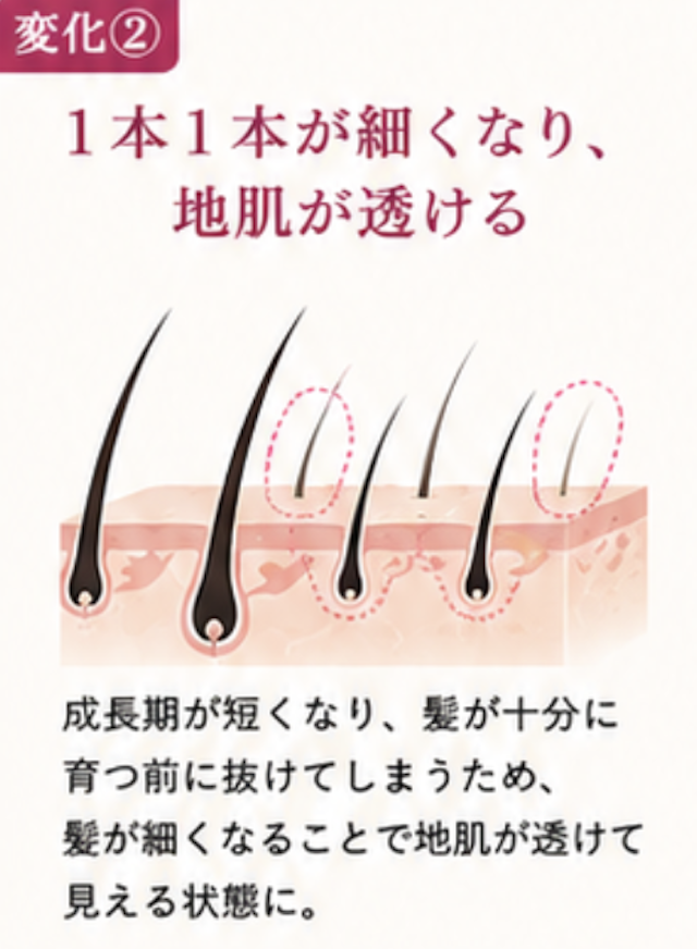 変化2